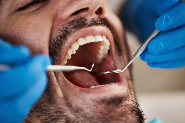 Best Emergency Tooth Extraction in Garden Home Whitfd, OR
