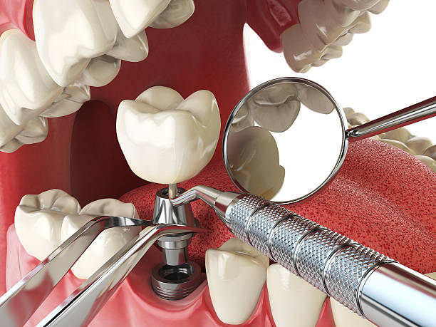 Best Walk-In Emergency Dentist in Garden Home Whitfd, OR